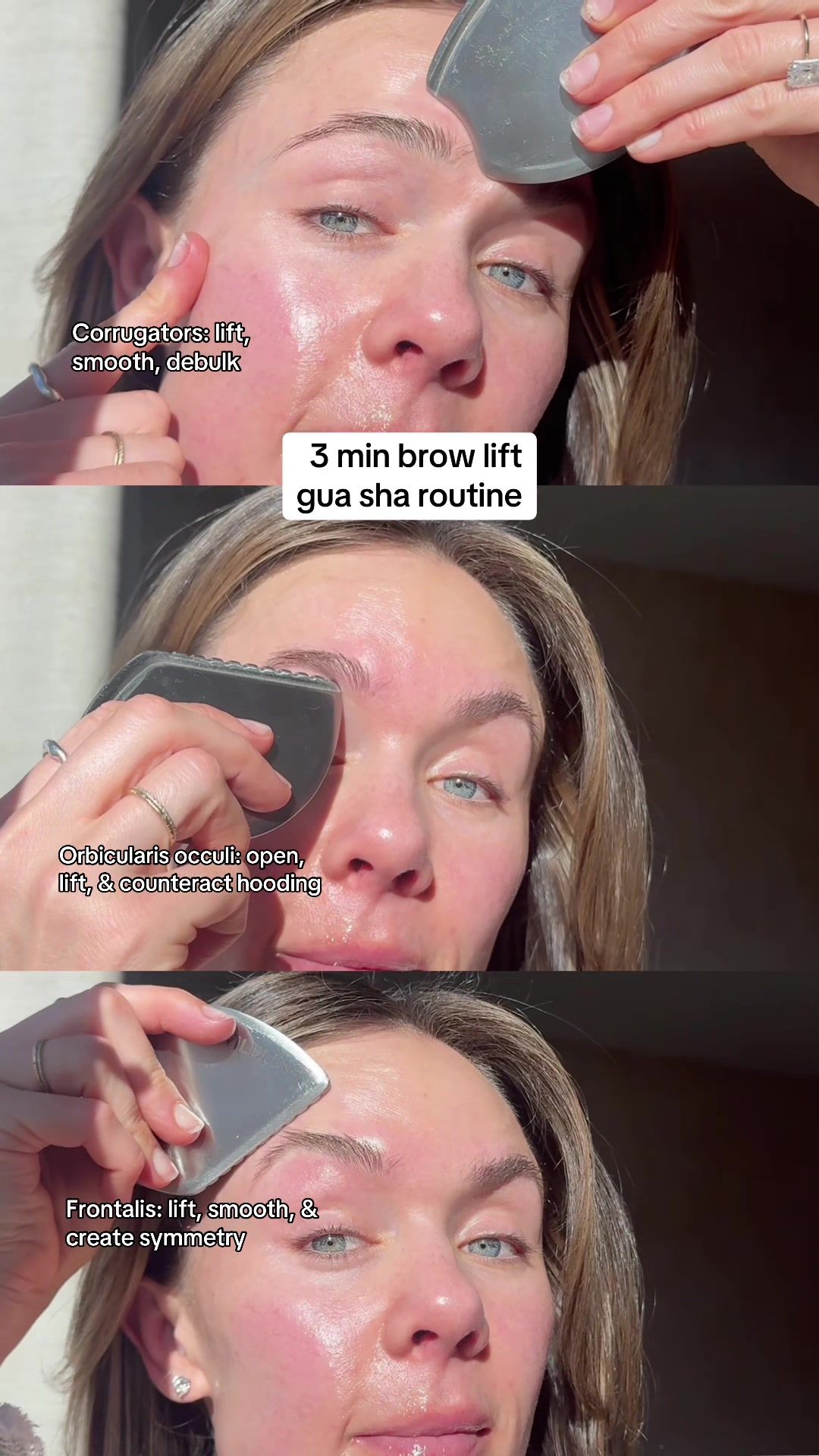 @Celeste | RN acne expert