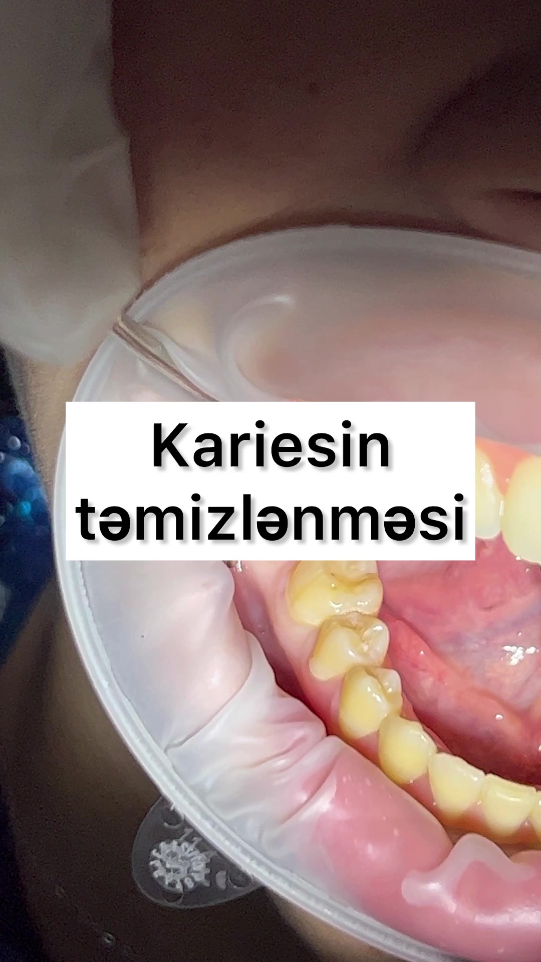 @eltakindentistry