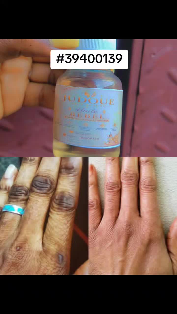 @Nursejudoue_39