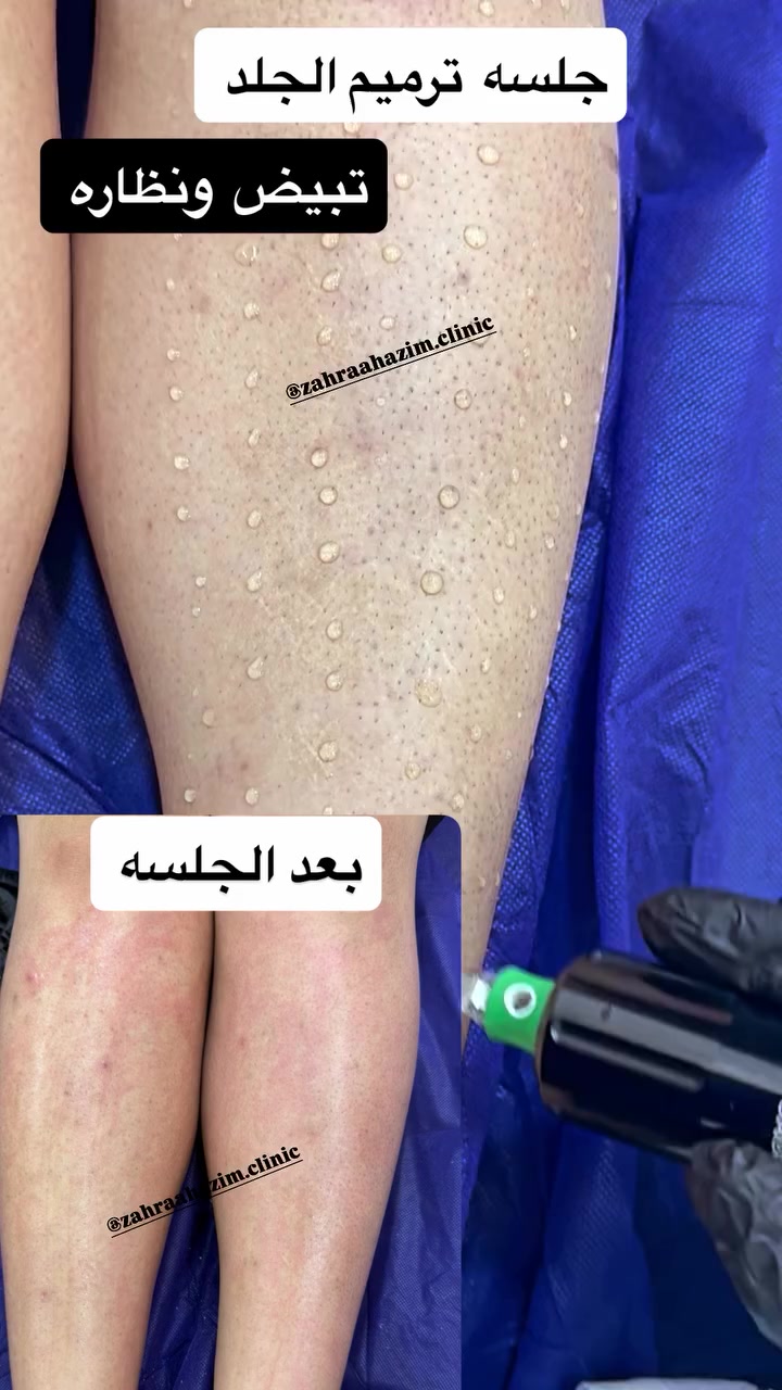 @الدكتورة زهراء حازم