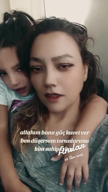 @Elmas kalay