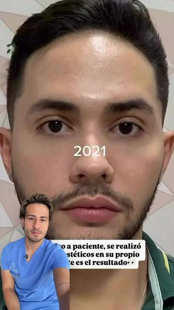 @chrisantiage