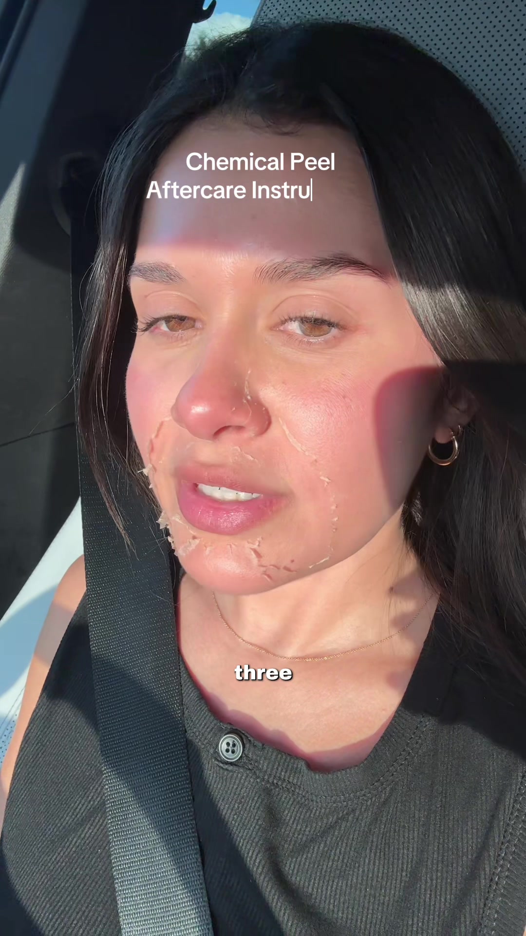 @Amanda | FL Aesthetic Injector
