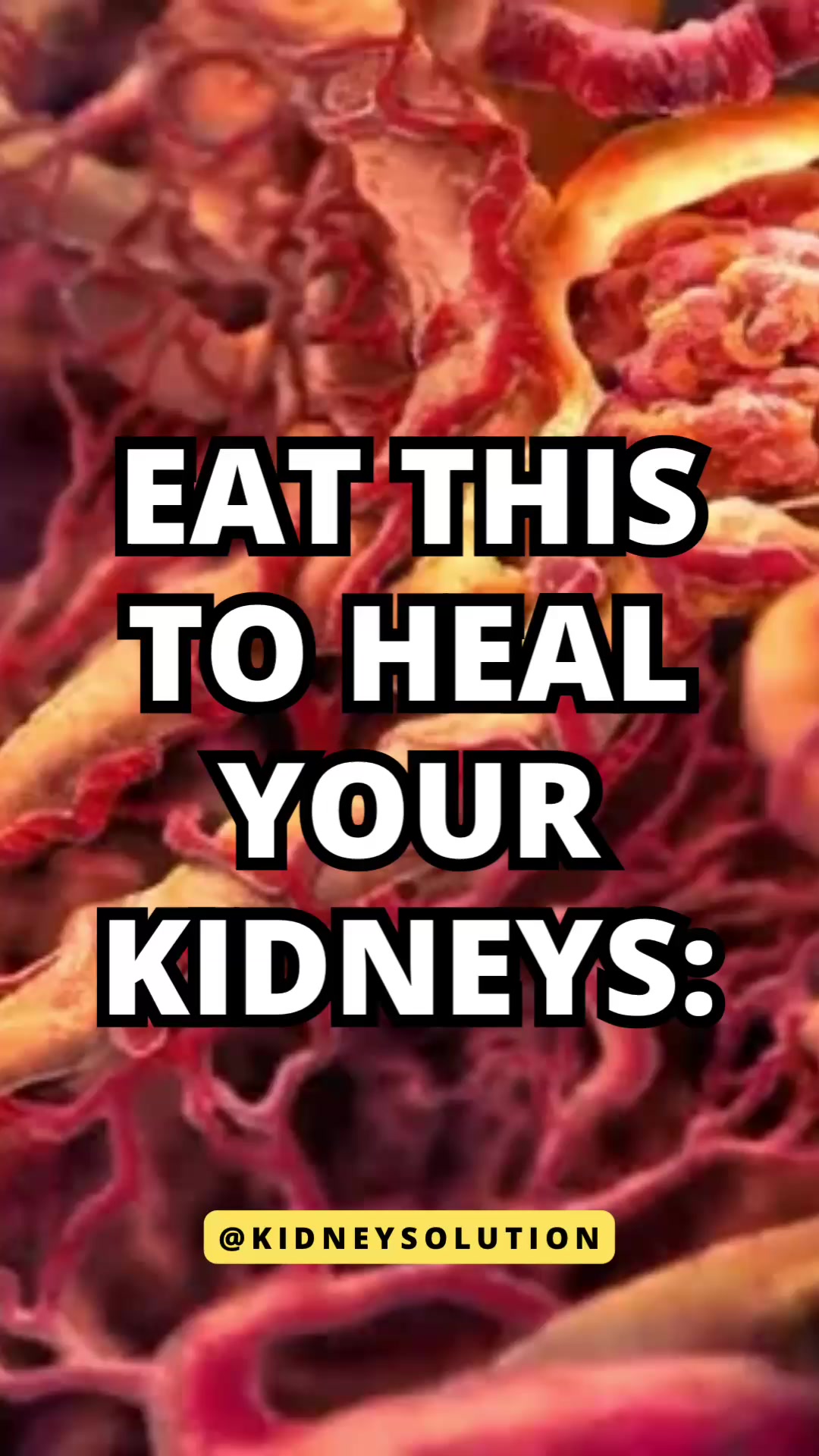 @Kidneysolution