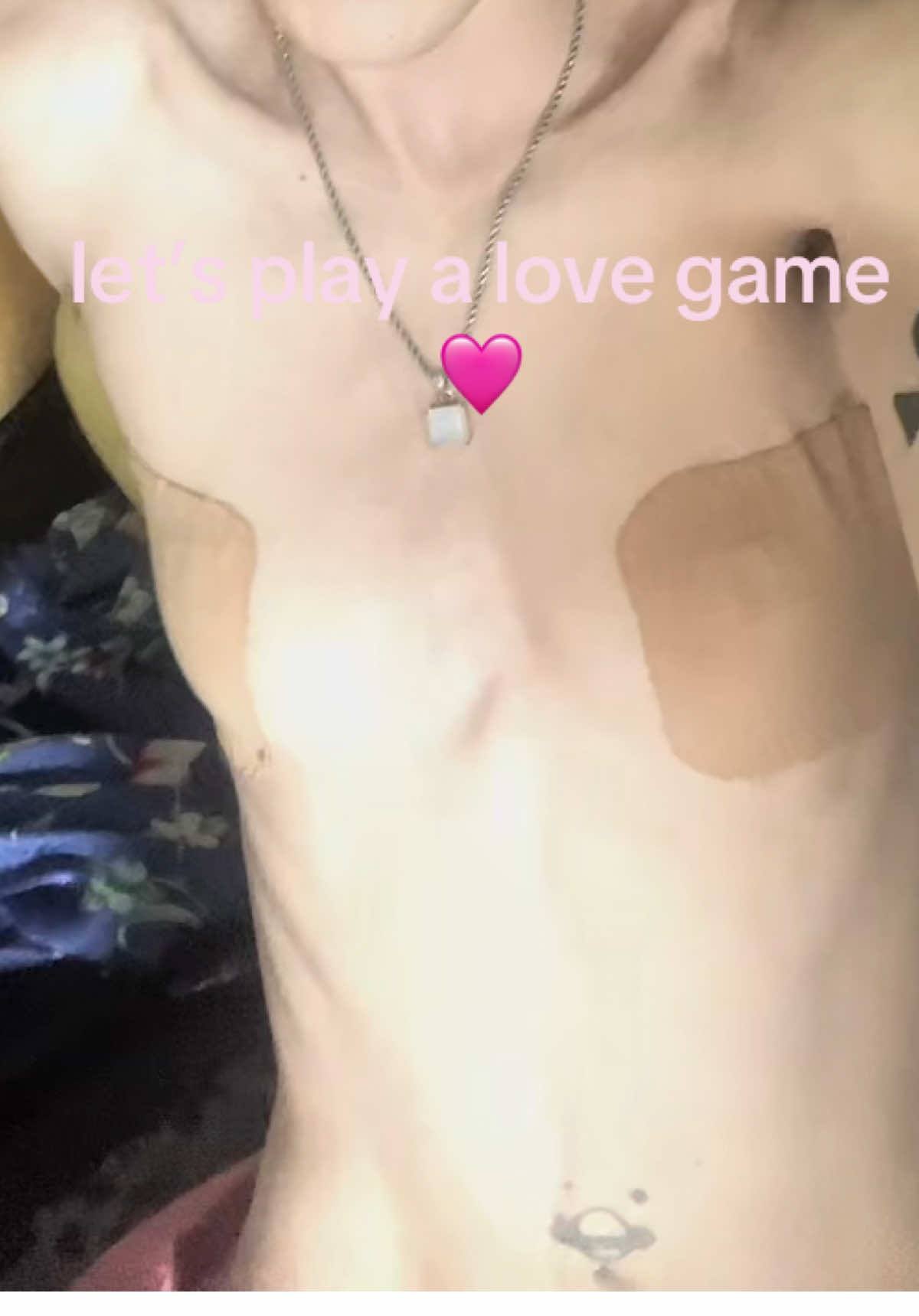 @𝕷