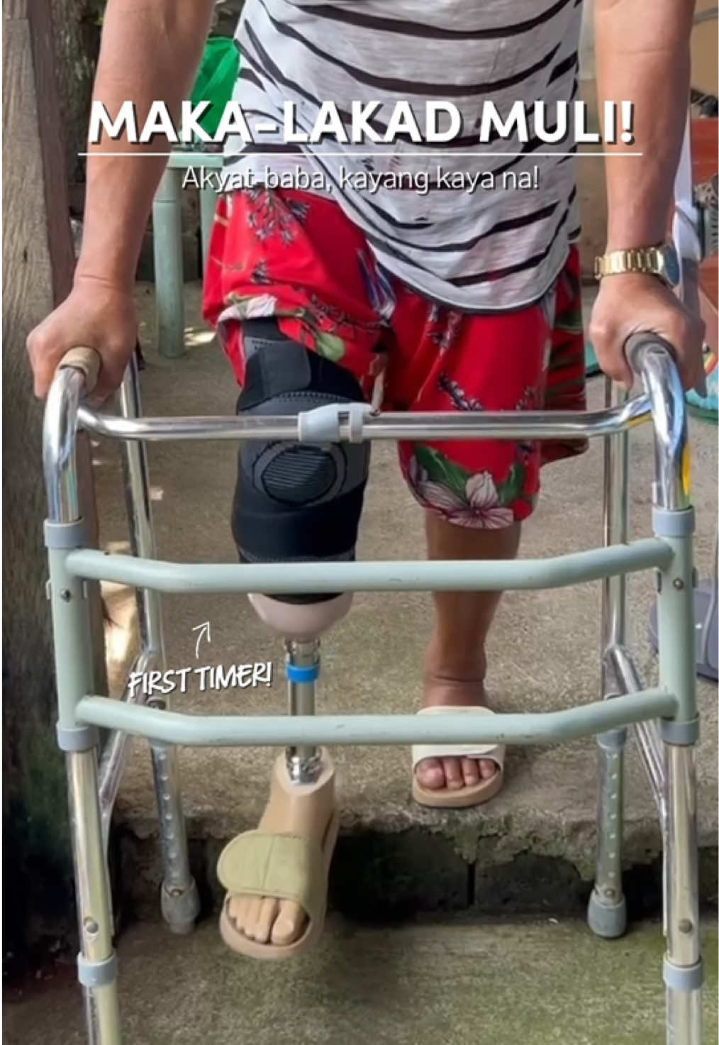 @Ogette Prosthetics & Orthotics