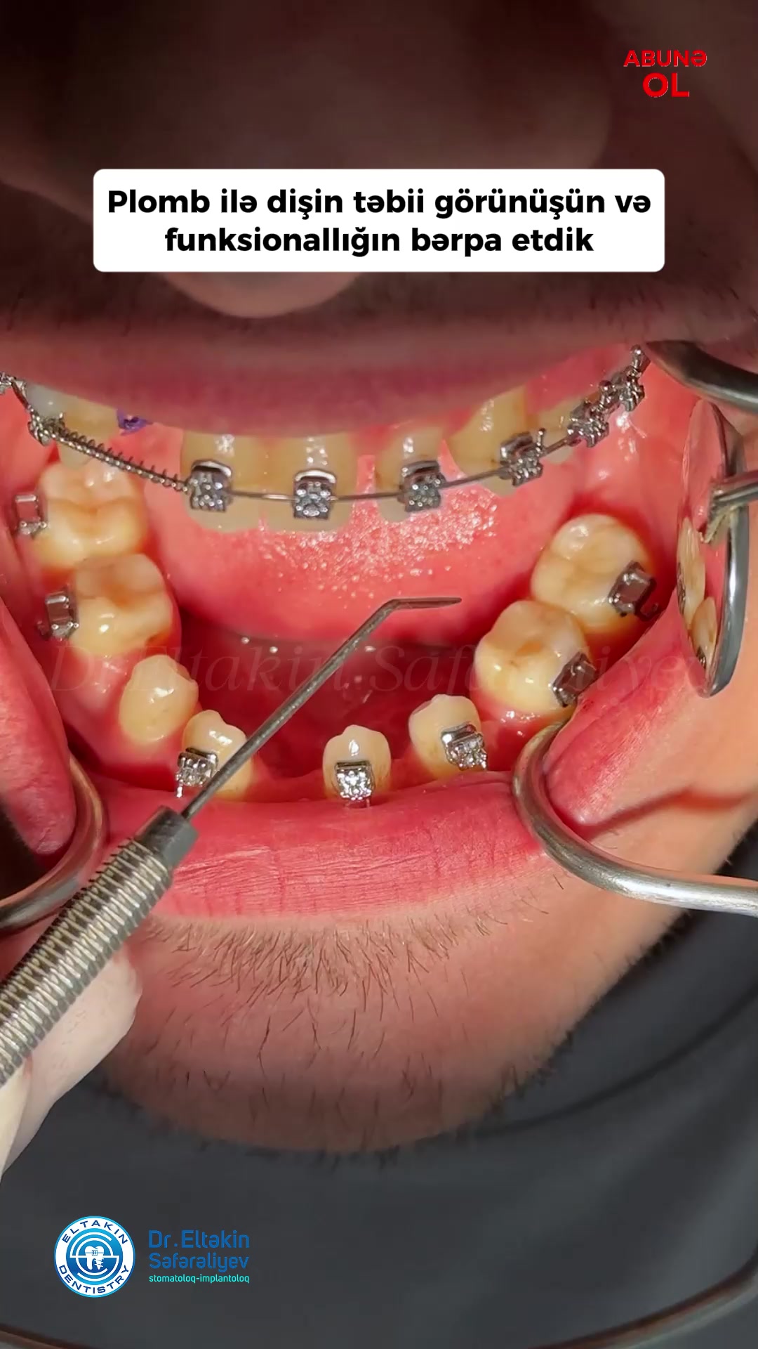 @eltakindentistry