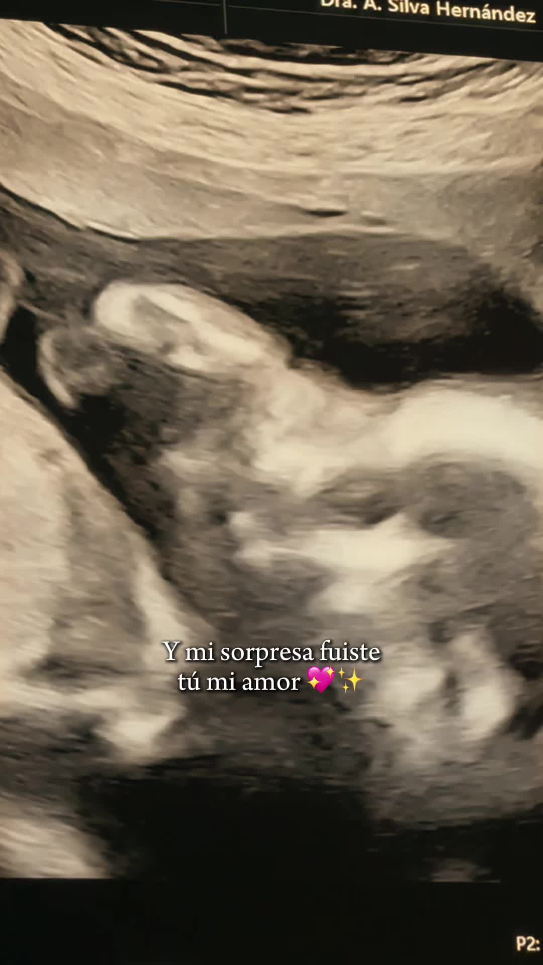 @Yamileth🌻