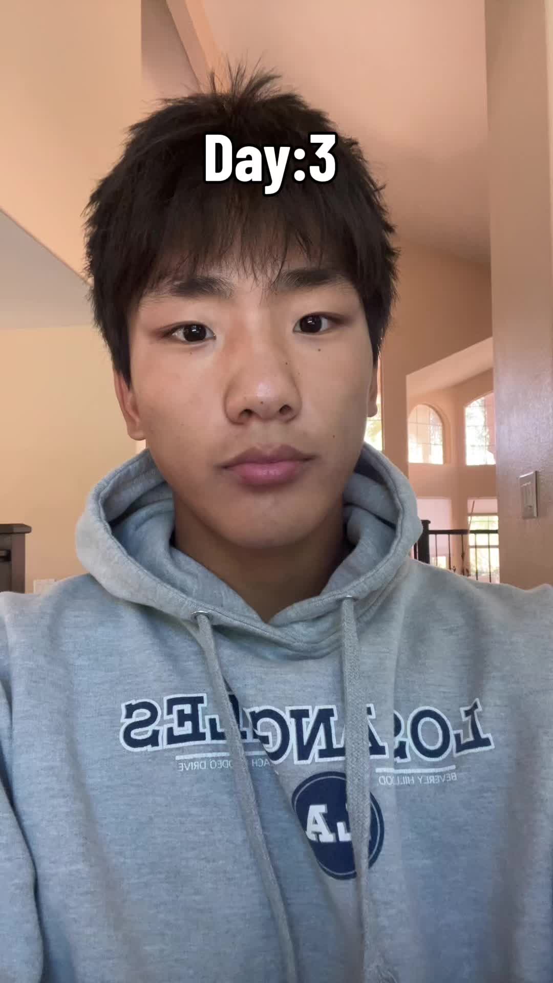 @Bpup