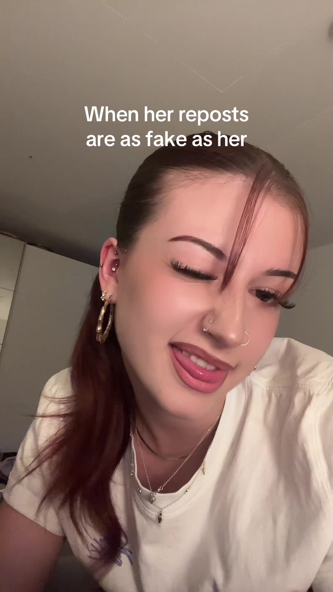 @rani🎰