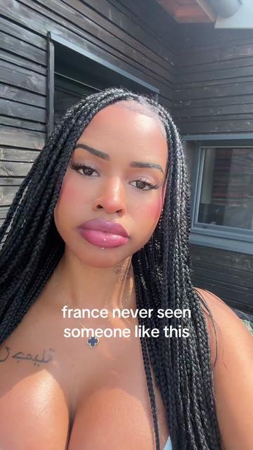 @🍒
