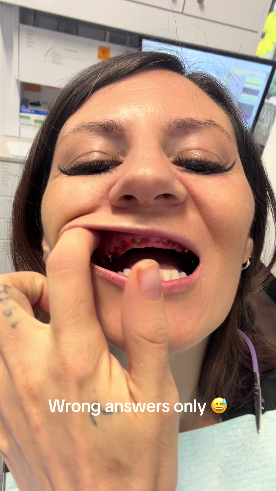 @Taylor Toothtales 🦷