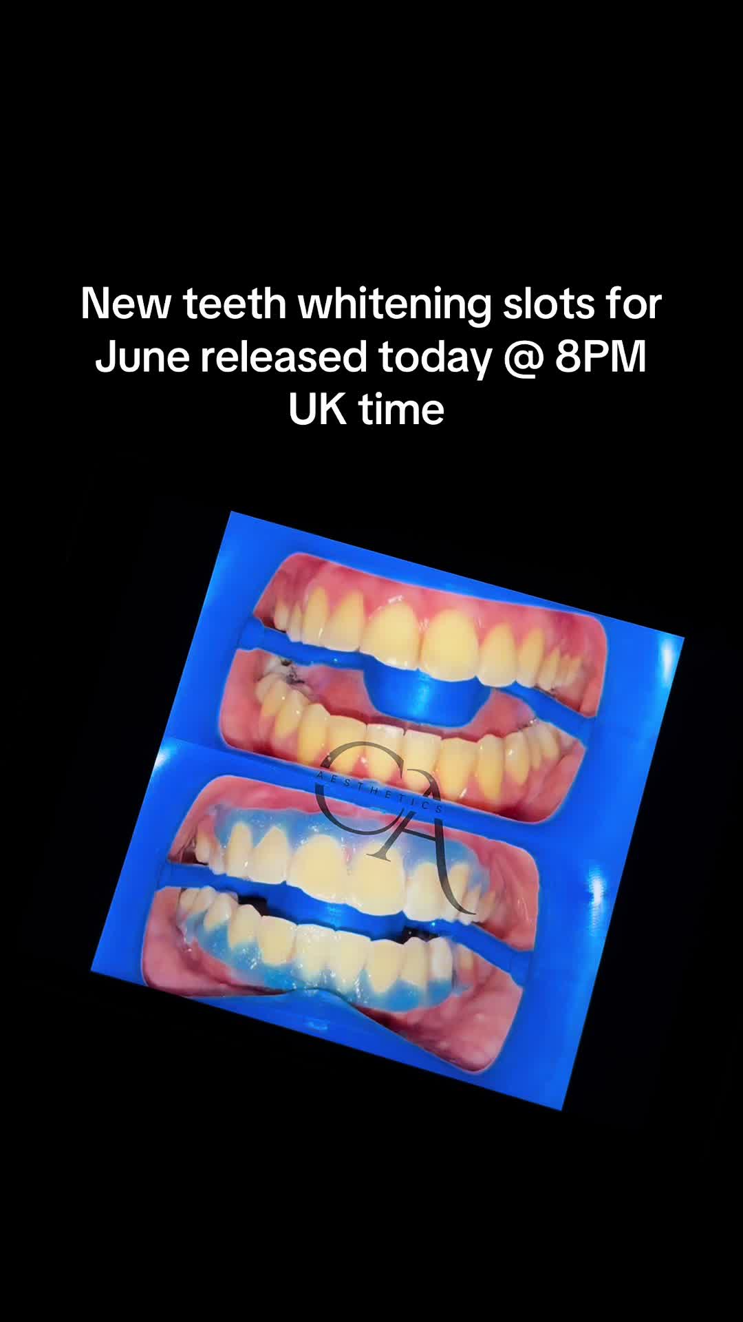 @Halal Teeth Whitening London
