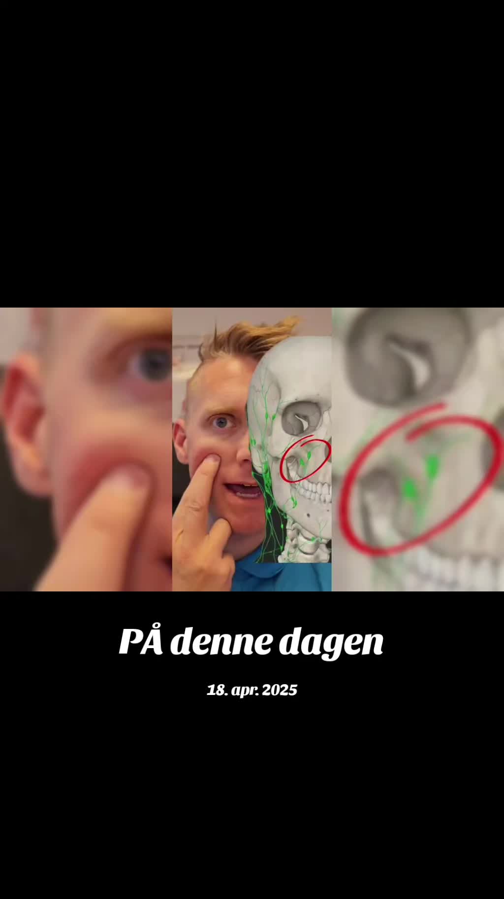 @Rune &Aring;b&oslash;