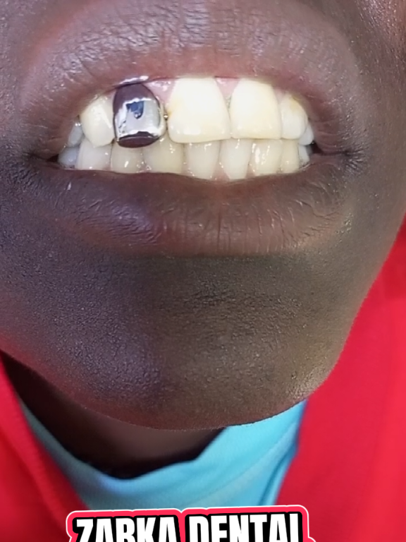 @Zabka Dental