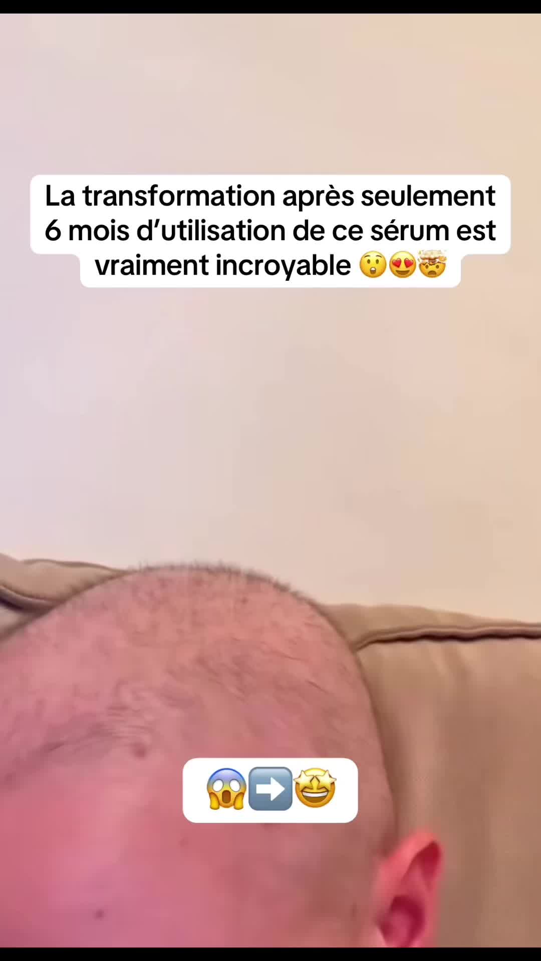 @Lux&rsquo;Hair Growth Paris