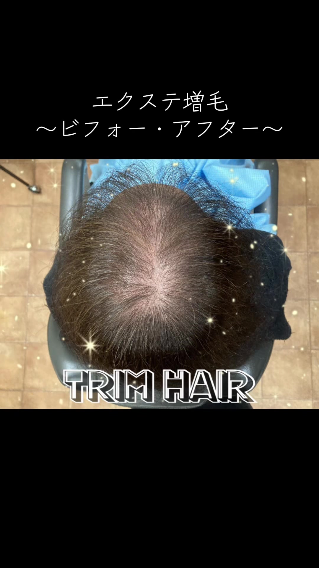 @Trim Hair