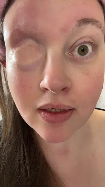 @eyeofthesarcoma