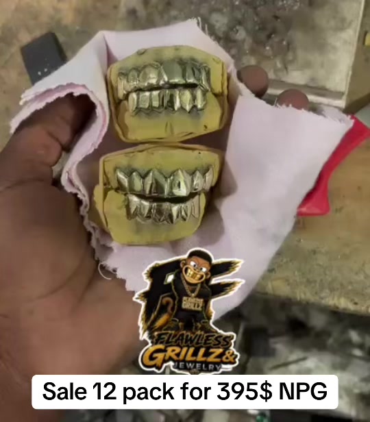 @Flawless Grillz