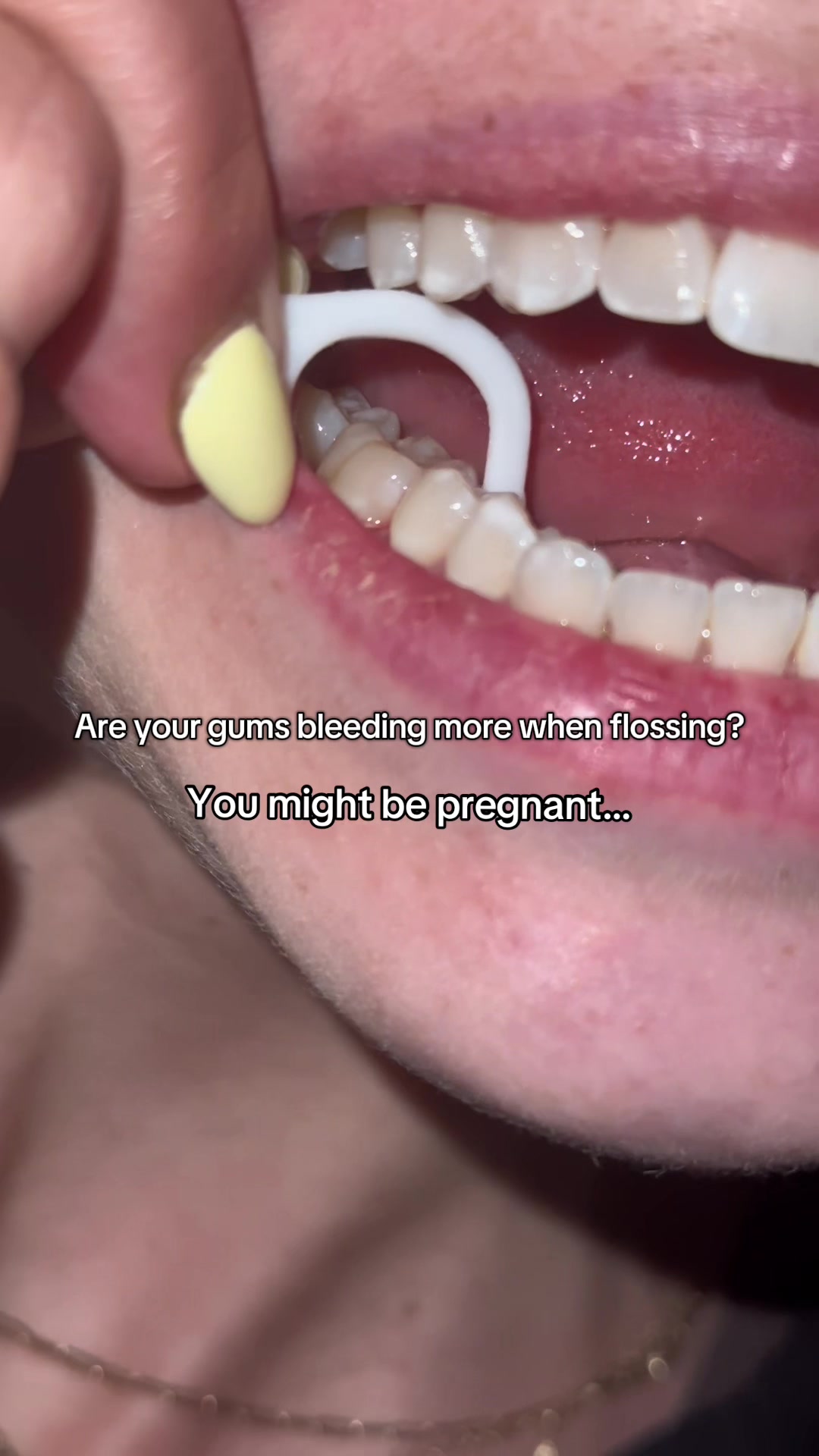 @Elementa&ensp;Silver&ensp;Oral&ensp;Care
