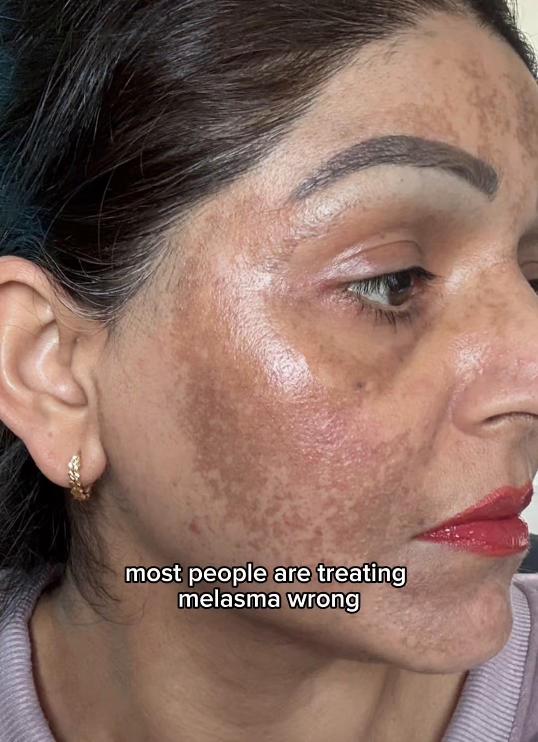 @Skin Consult