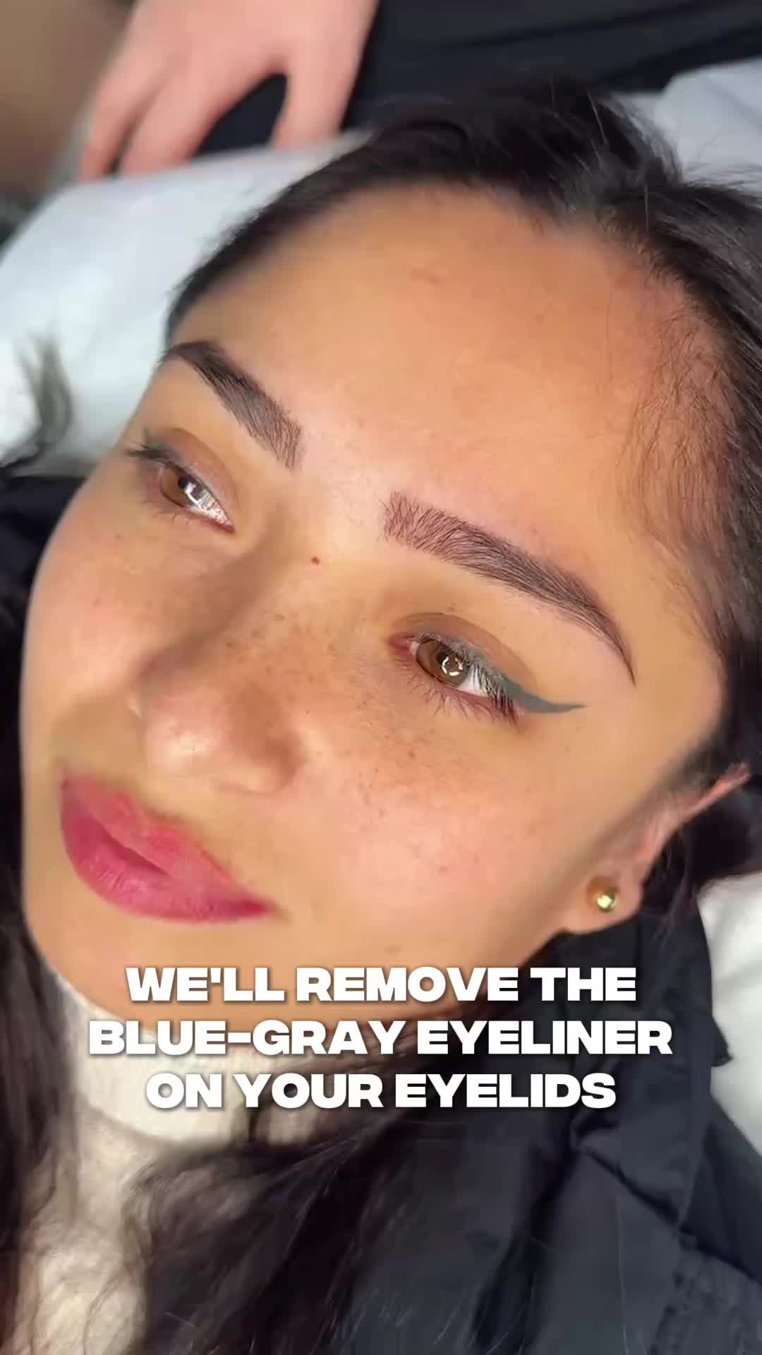 @Safe Eyebrows Tattoo Removal🗽