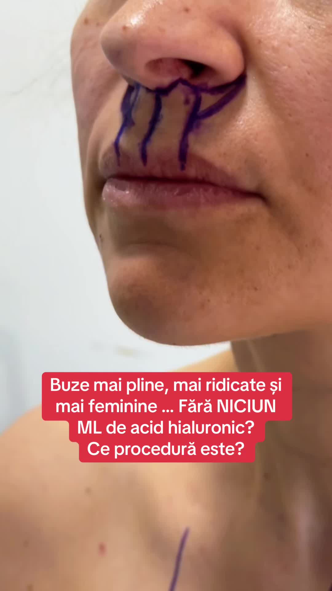 @marhaba_estetica