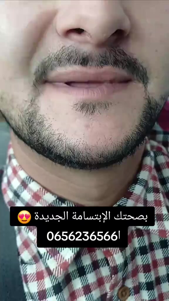 @Dr Ramdani Rassim