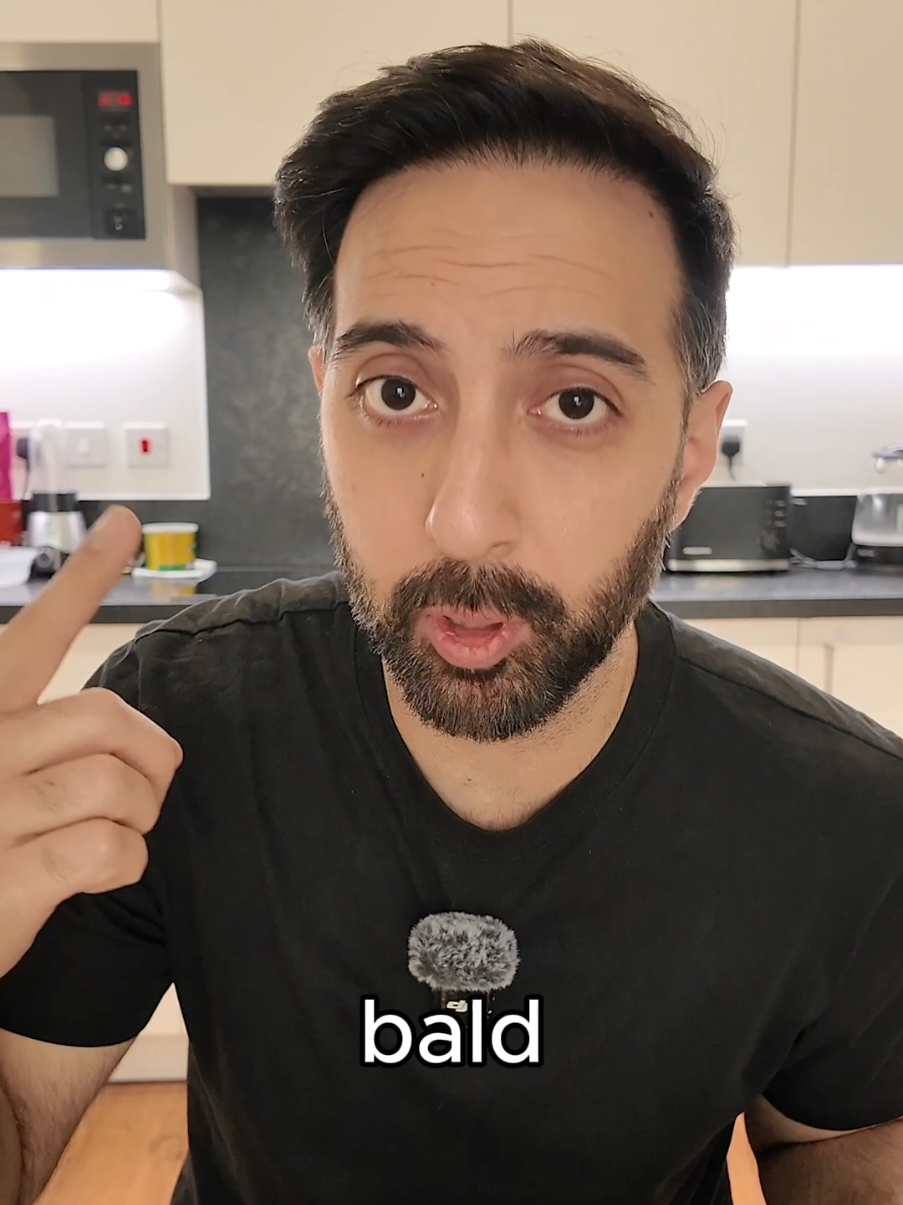 @Amit | Hair Transplant Tips