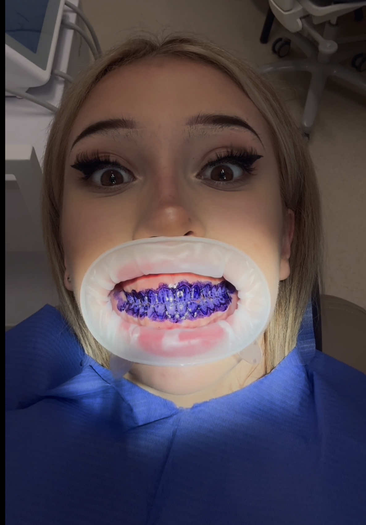 @ig natydrobnaaa