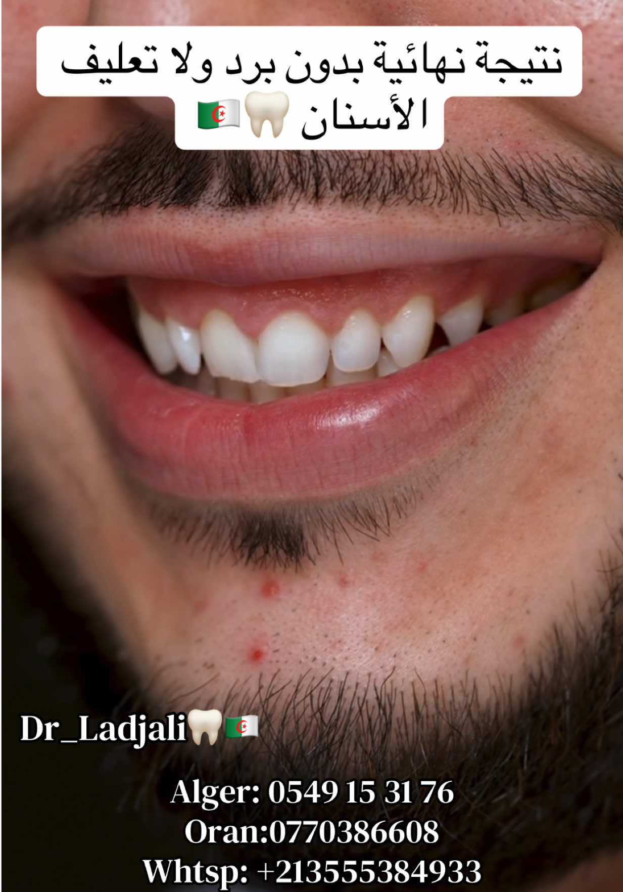 @Dr.ladjali