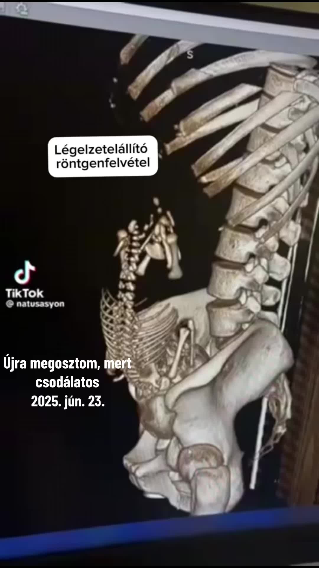 @Vörös Dóra