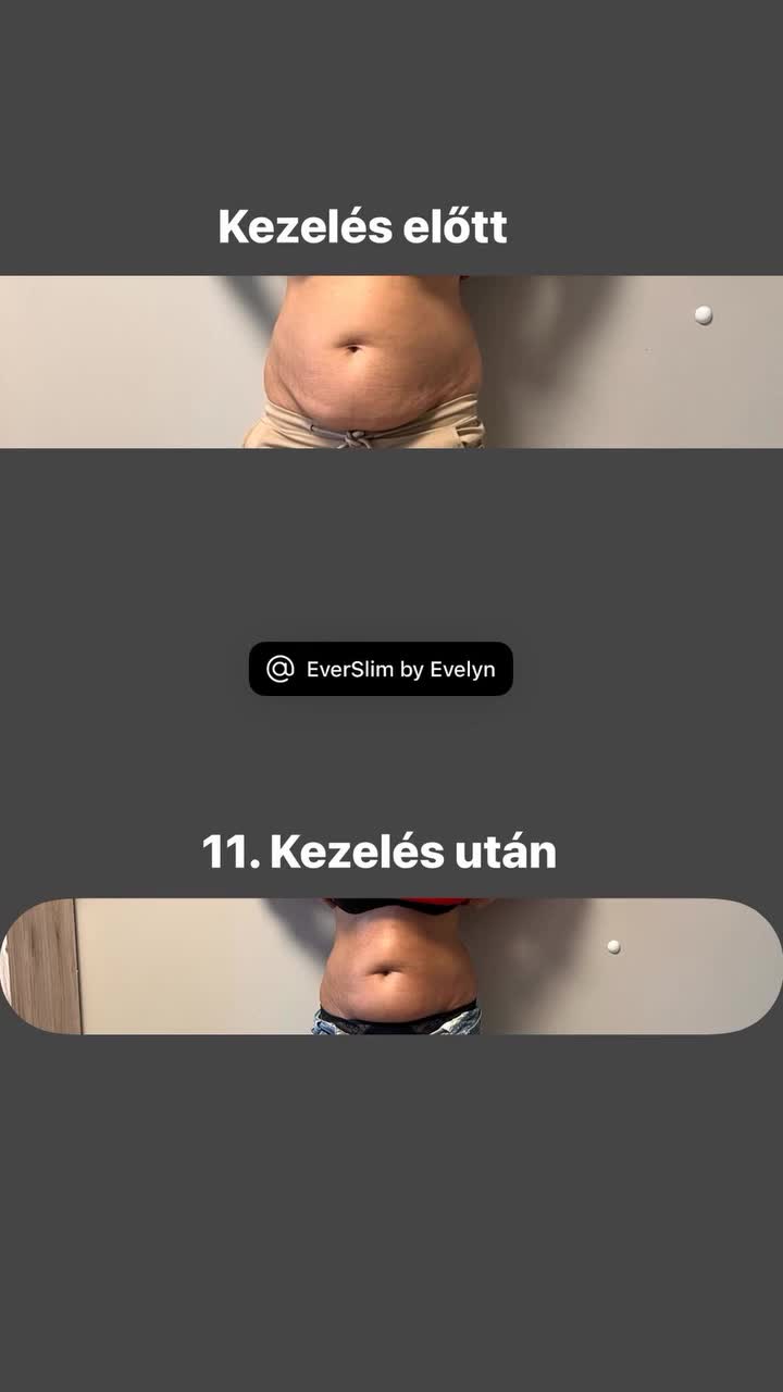 @EverSlim by Evelyn🌸