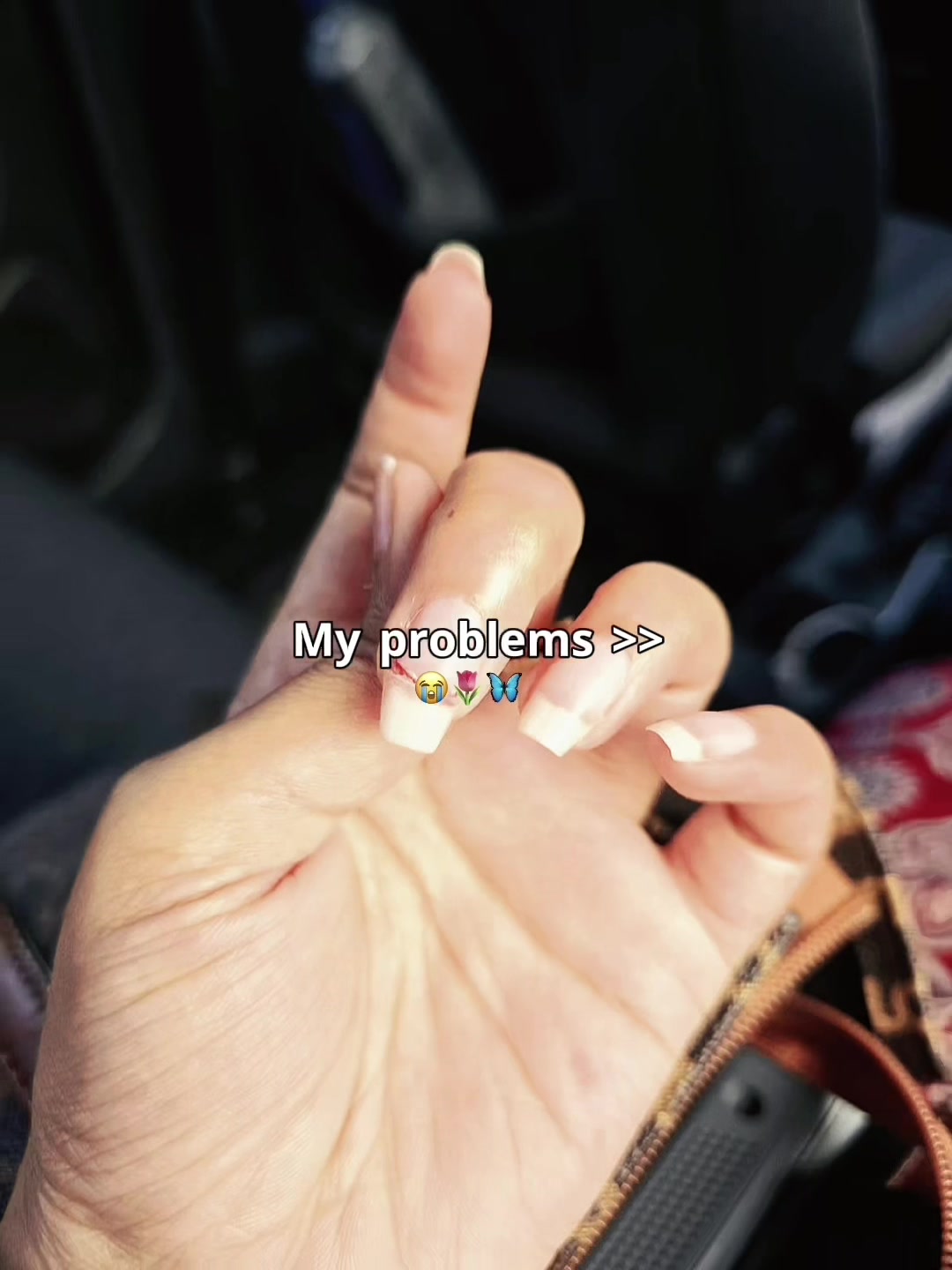 @๐แดสสแด โ
