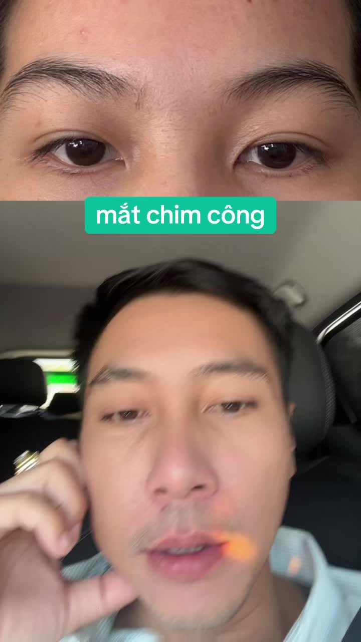 @Tuệ Nhãn ✅