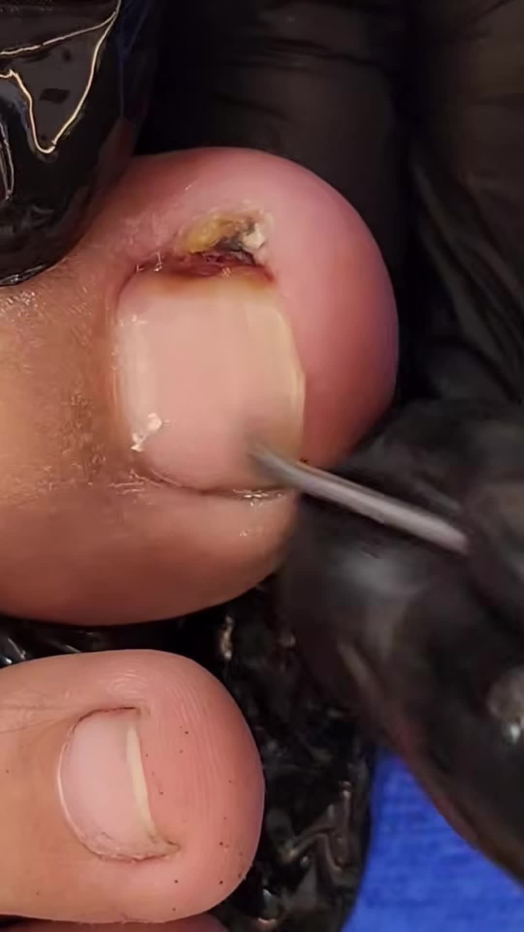 @Toenails.clips