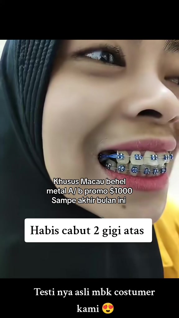 @mbak-Paijem
