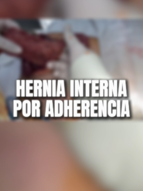 @Dr Julio Pérez