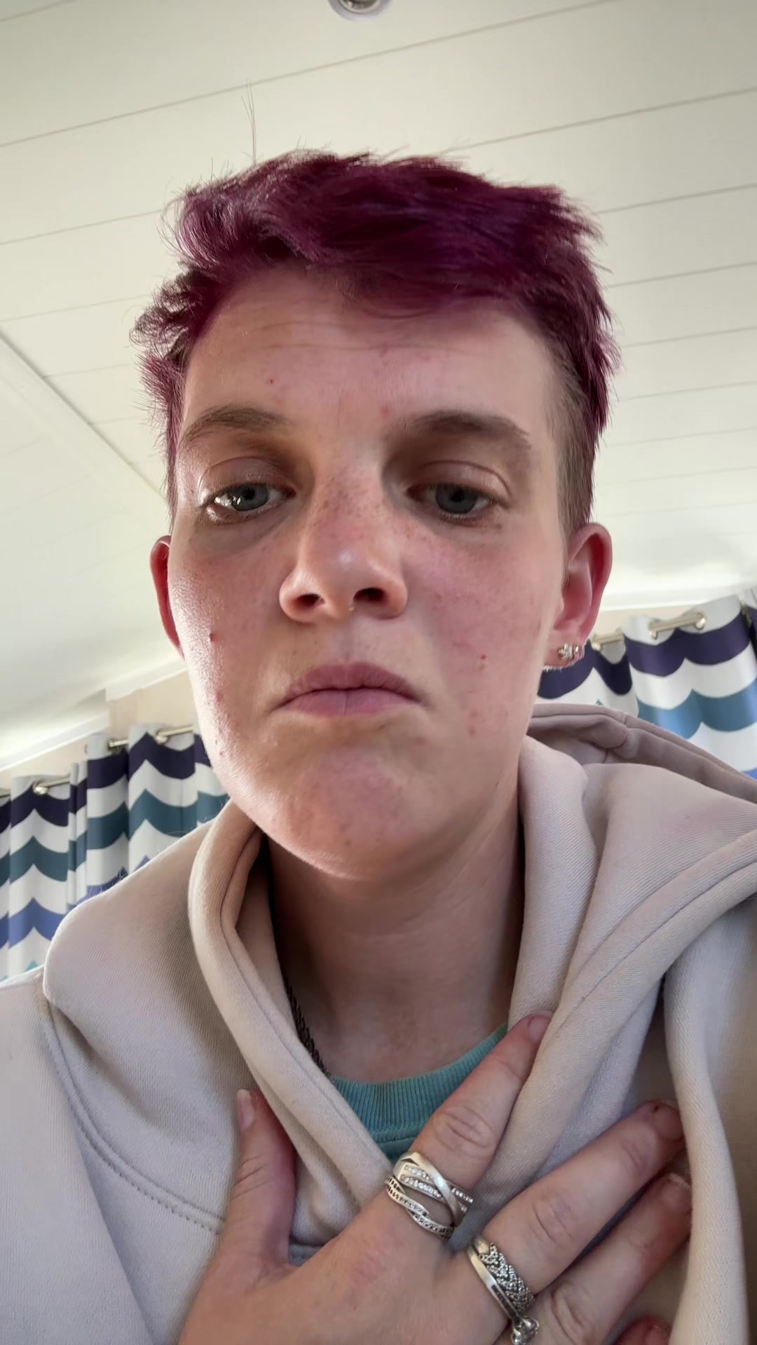 @snoopydog230