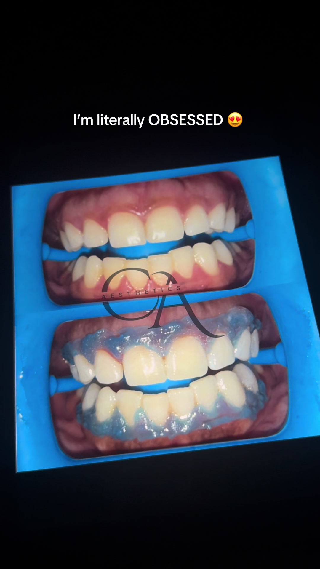 @Halal Teeth Whitening London