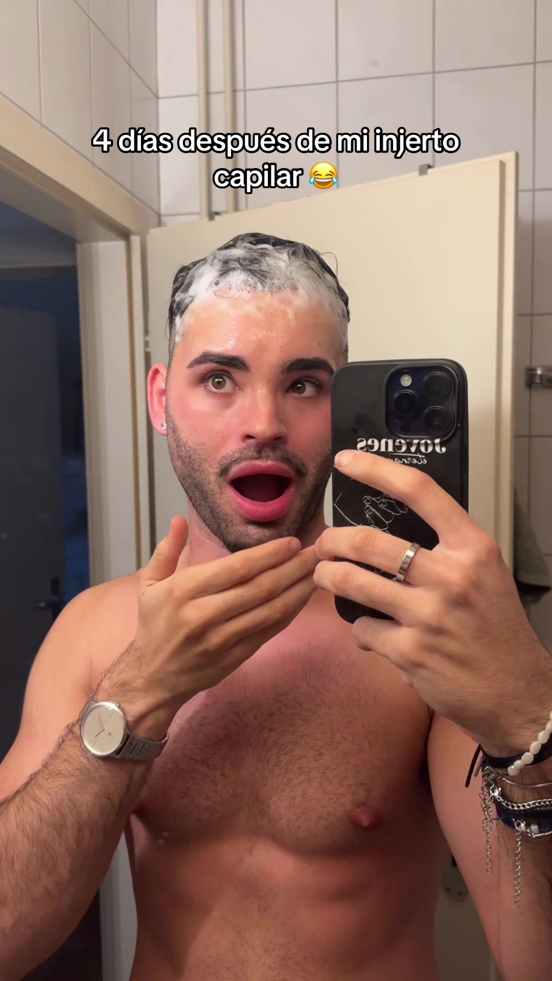 @kevinnCarrera