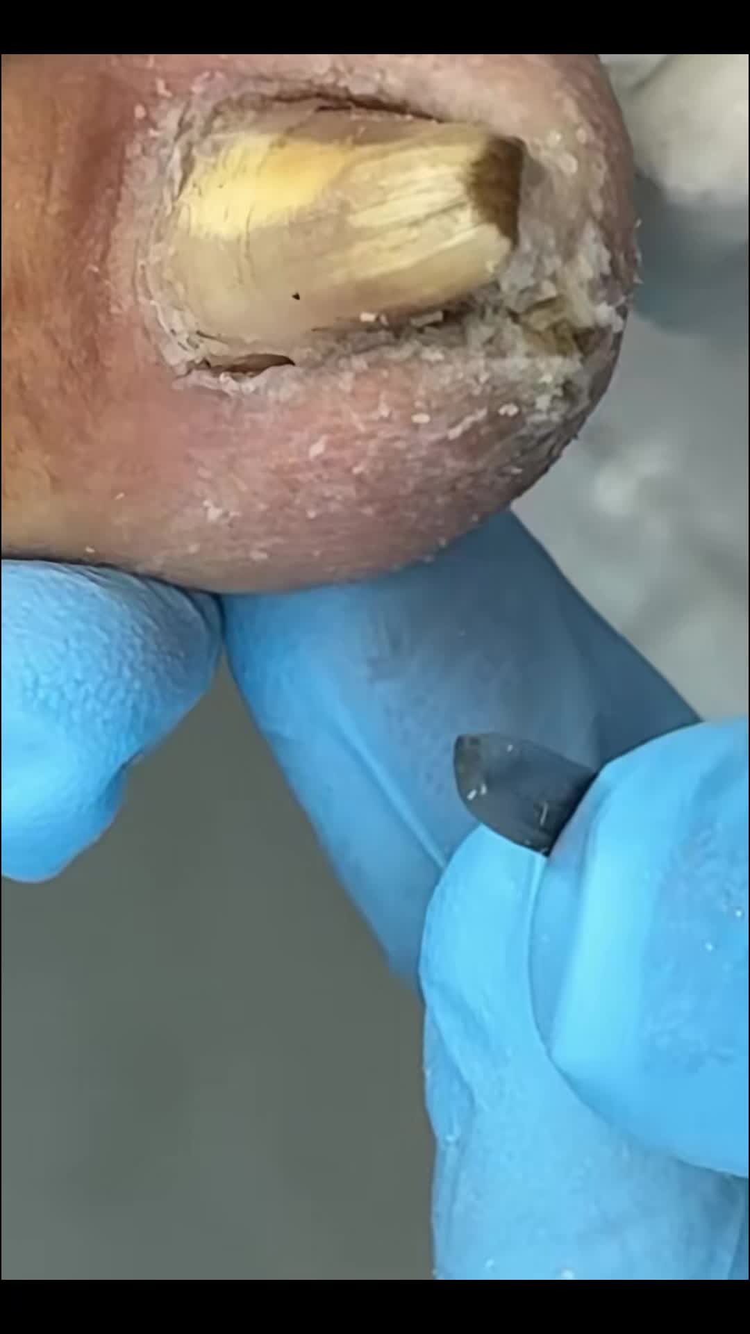 @Toenails.clips