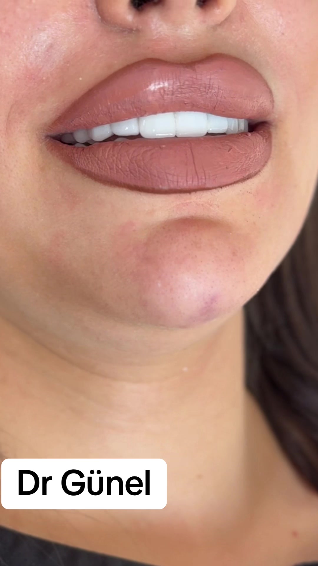 @Dentist_Günel