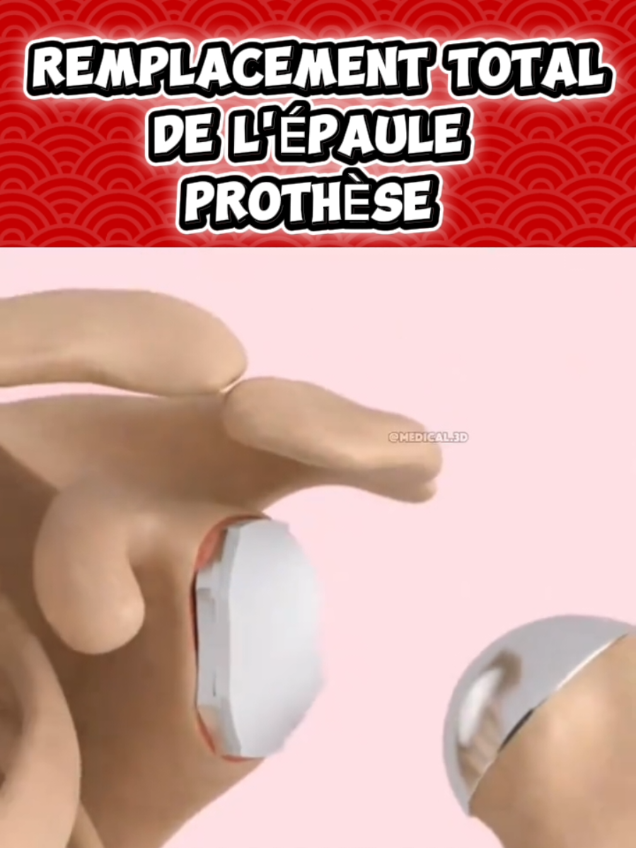 @Docteur Shepherd
