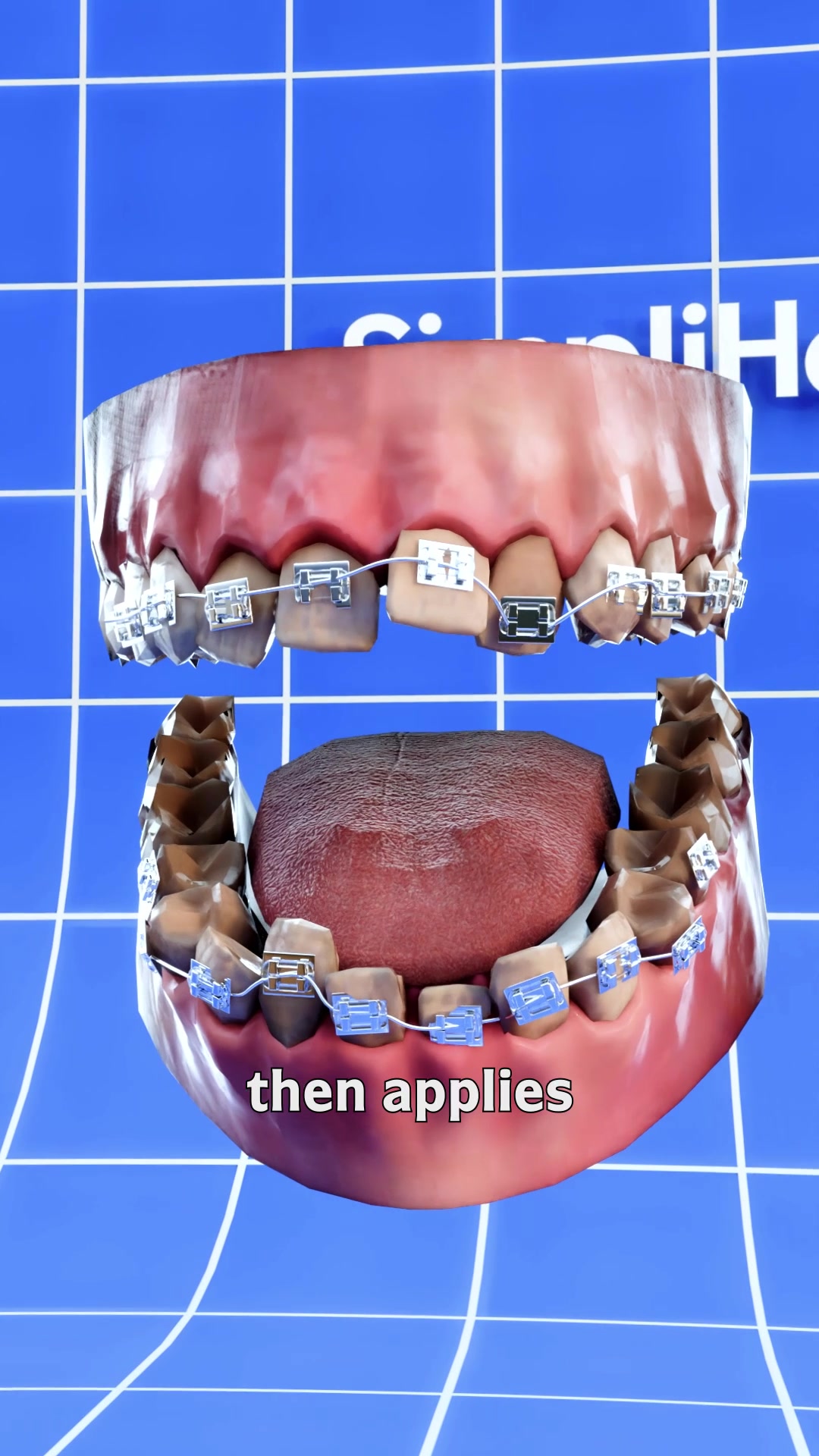 @simplihowww