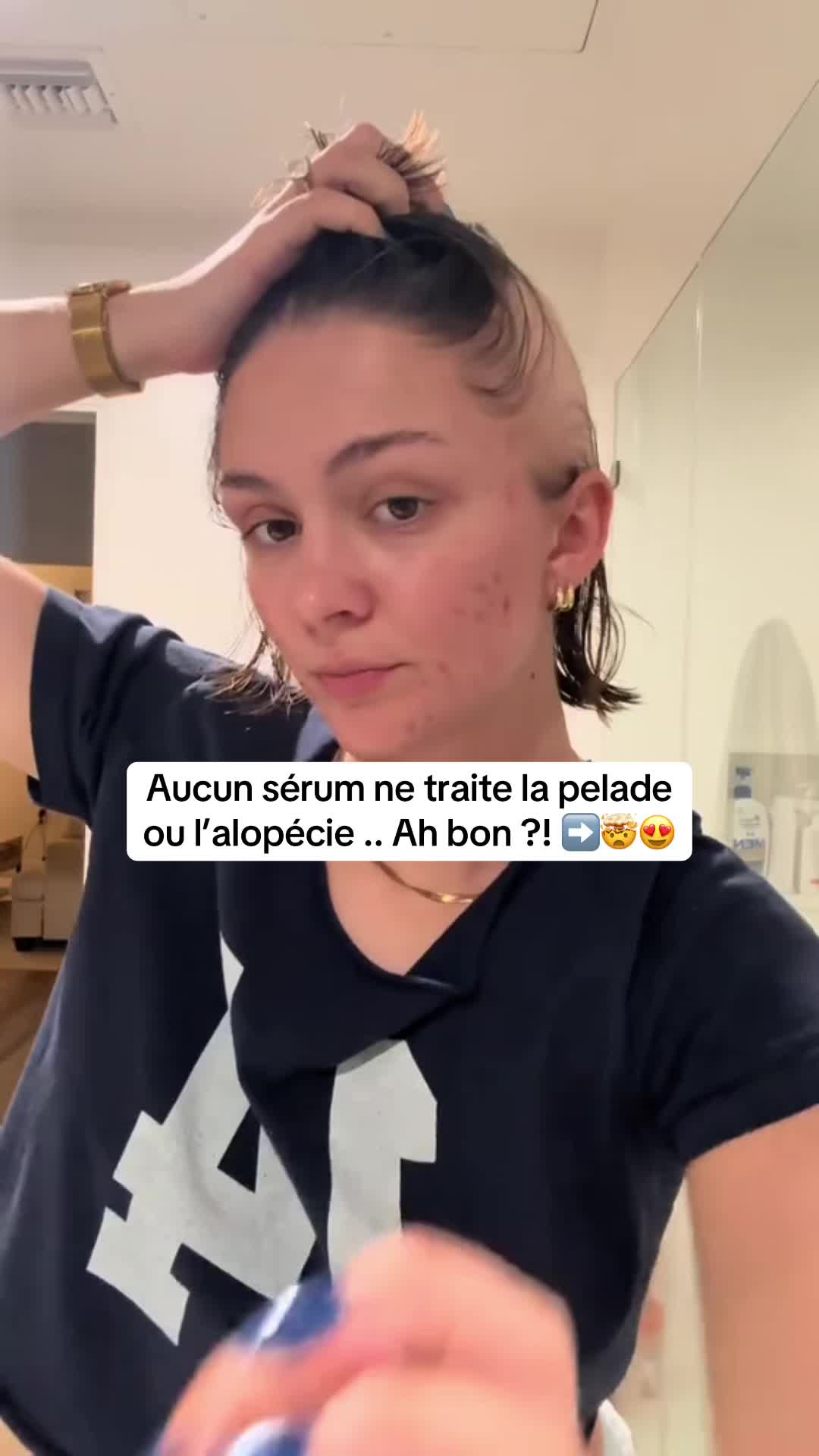 @Lux’Hair Growth
