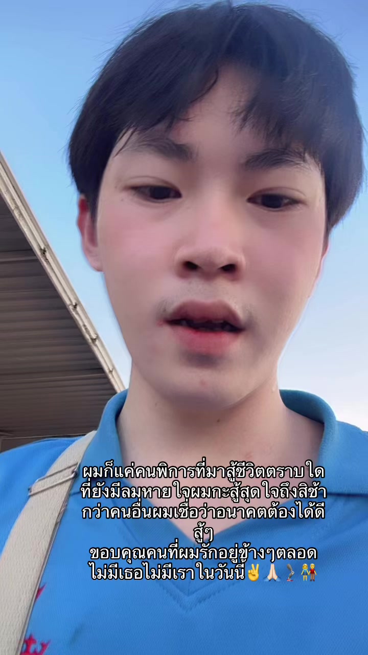 @ช่างม่อนขาแต่ง🦿