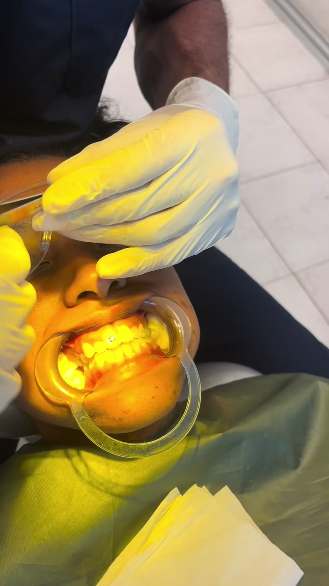 @Lo