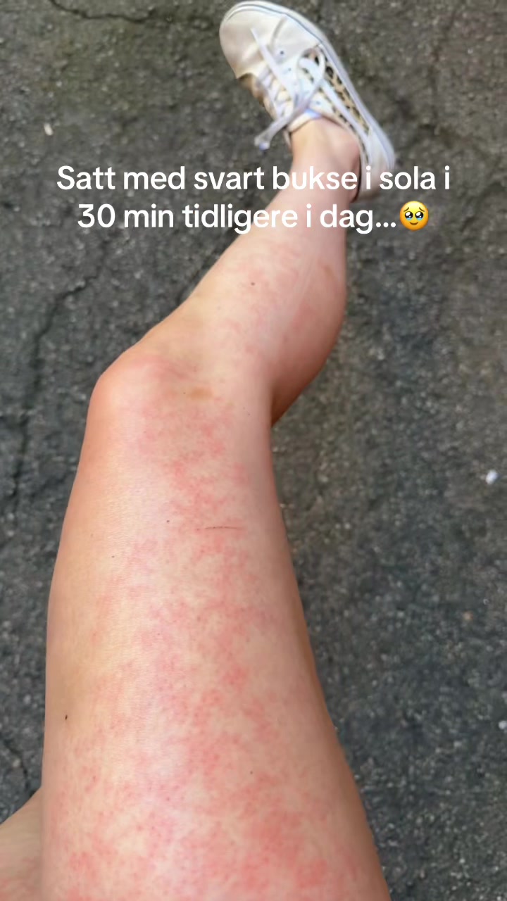 @THEA EDVARDSEN