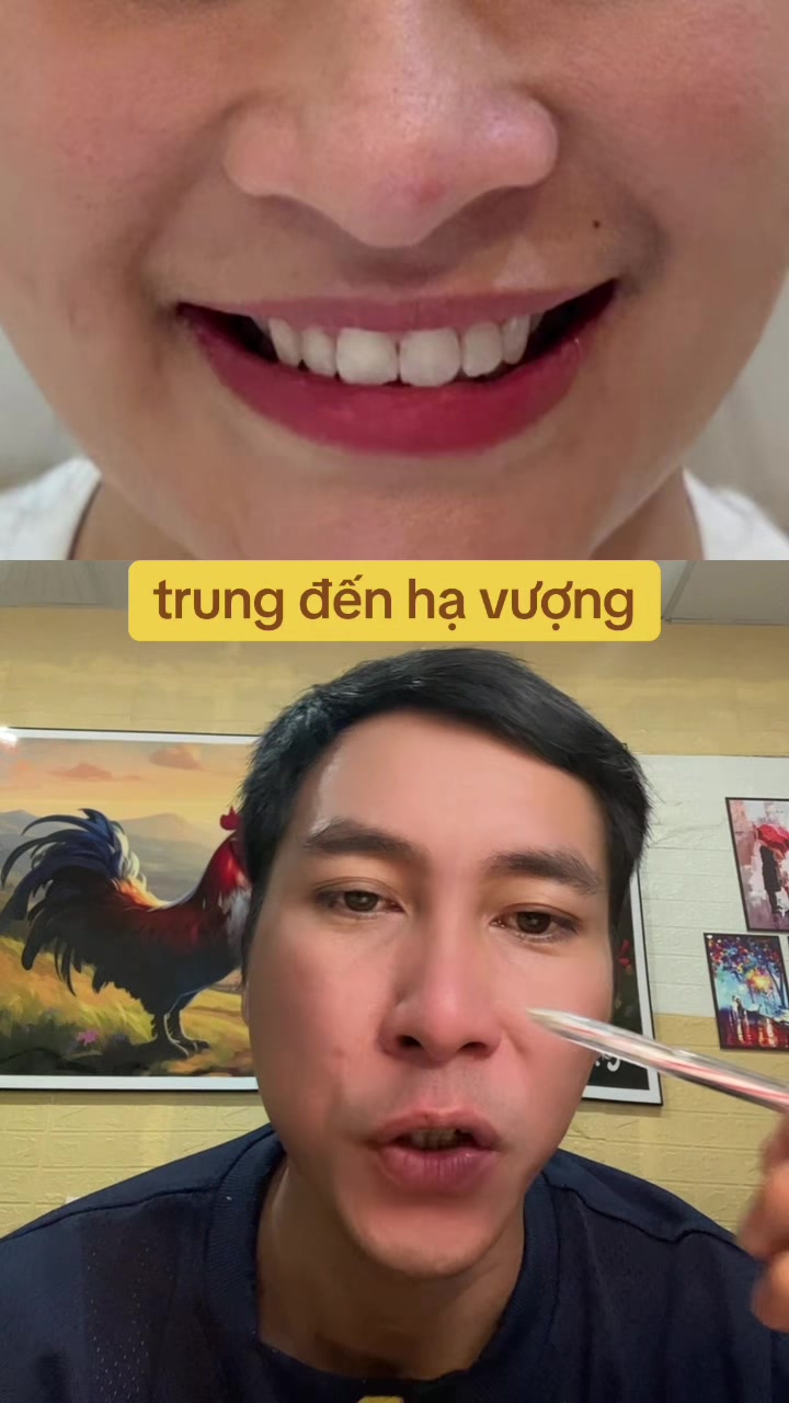 @Tuệ Nh&atilde;n ✅